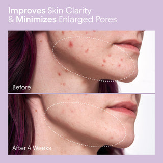 Rise & Refine Routine