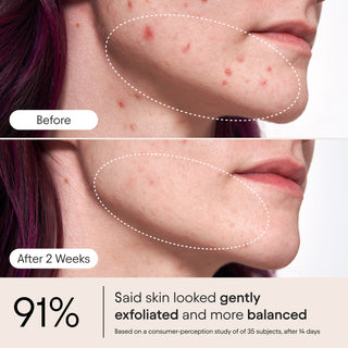 Pore Perfecting Liquid