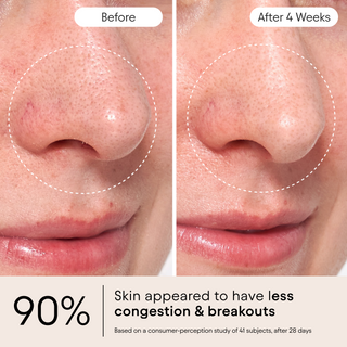 Clarifying Facial Oil