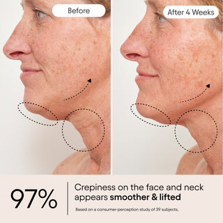 Alpyn's Total Renewal Ritual