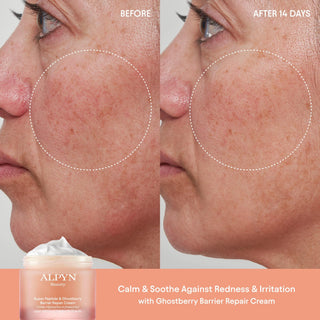Super Peptide & Ghostberry Barrier Repair Cream before & after