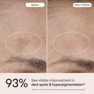 3-in-1 Barrier Repair Serum (Launches 8/25)