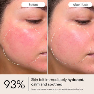 Alpyn's Total Renewal Ritual