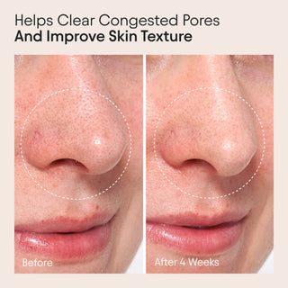 Clarifying Facial Oil