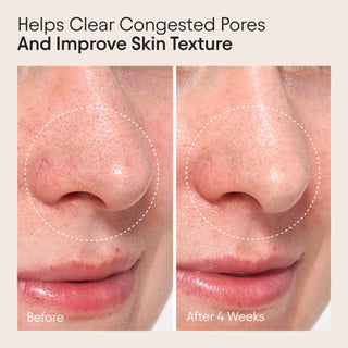 Clear Skin Full Reset