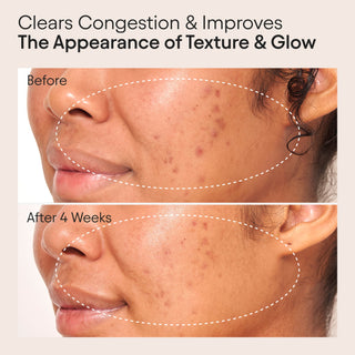 Clarifying Facial Oil