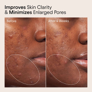 Clear Skin Full Reset